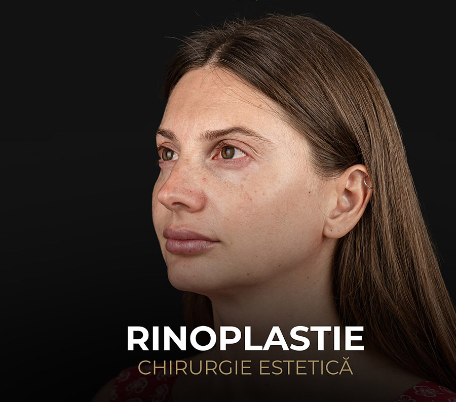 Почему ринопластика является одной из самых востребованных эстетических процедур?